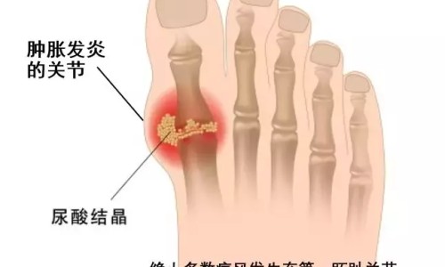 葵花熊胆痔疮膏-熊胆痔灵膏*葵花说明书-专业葵花熊胆痔灵栓多少钱一盒平台-葵花熊胆痔灵栓多少钱一盒